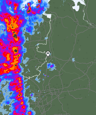Radar