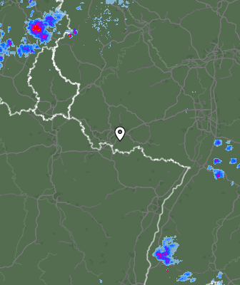 Radar