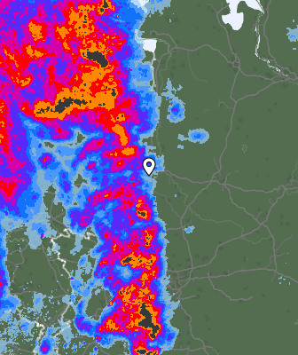 Radar
