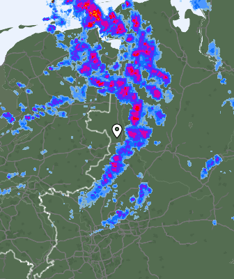 Radar