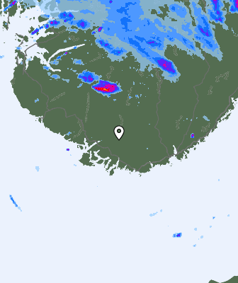 Radar