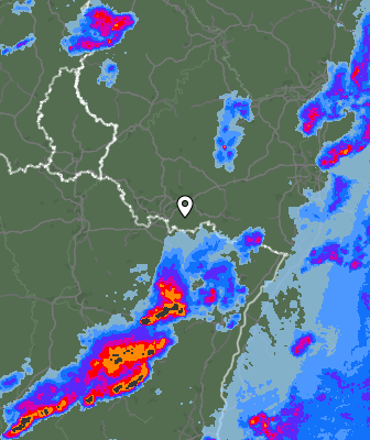 Radar
