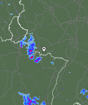 Radar