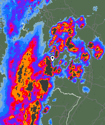 Radar