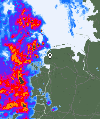 Radar