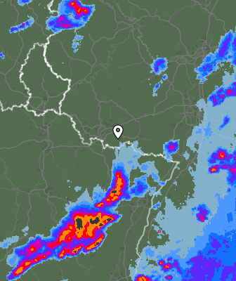 Radar