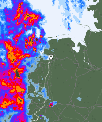 Radar