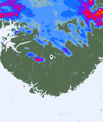 Radar