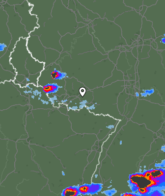 Radar