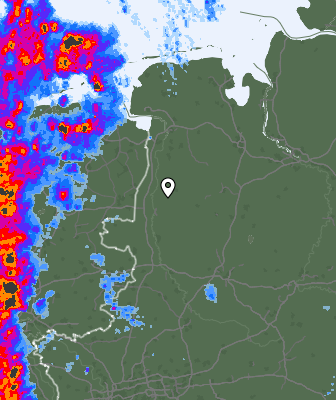 Radar