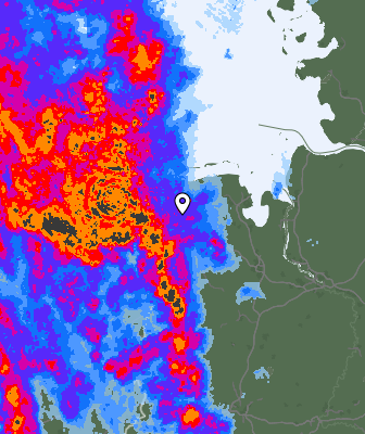 Radar
