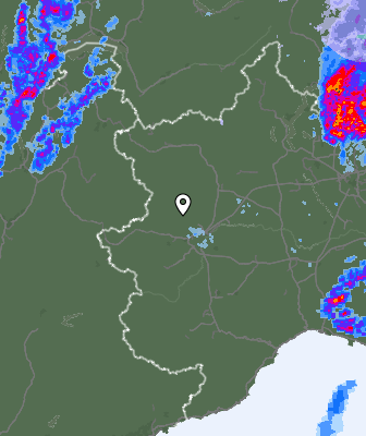 Radar