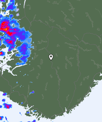 Radar