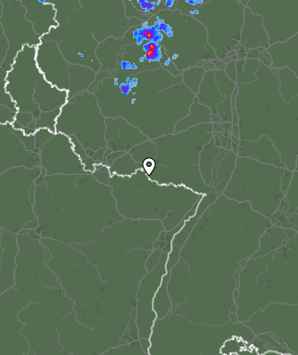 Radar