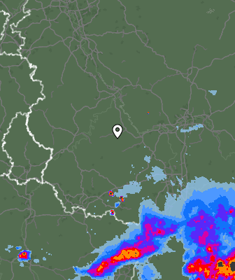 Radar