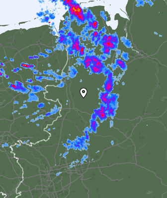 Radar