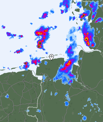 Radar