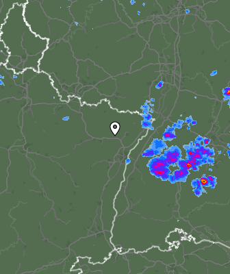 Radar