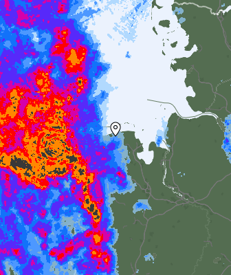 Radar