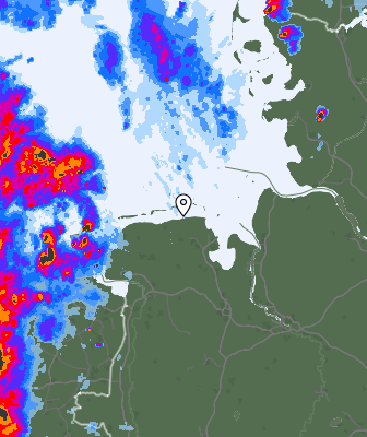 Radar