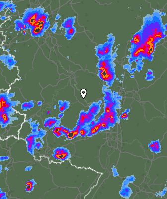 Radar