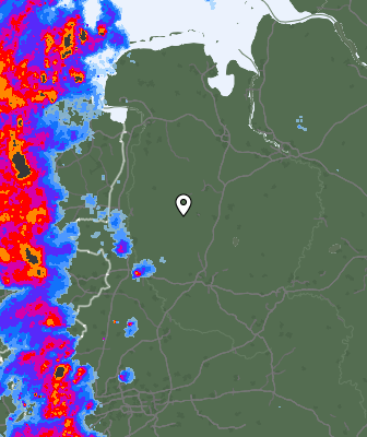 Radar