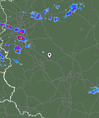 Radar