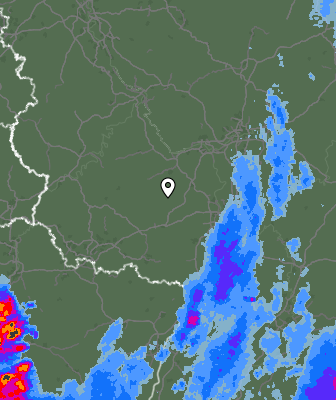 Radar