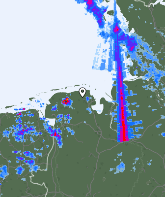 Radar
