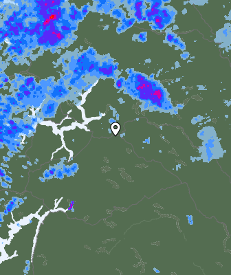 Radar