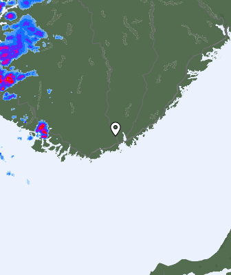 Radar