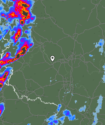Radar