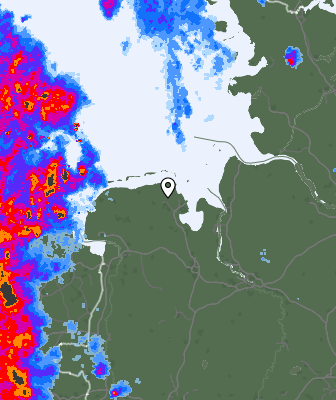 Radar
