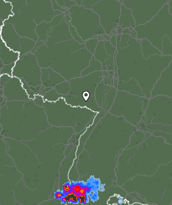 Radar