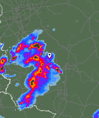 Radar