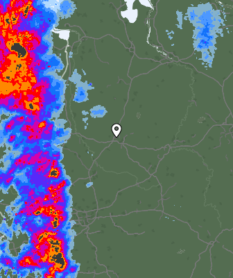 Radar