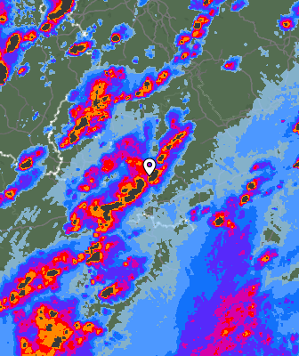 Radar