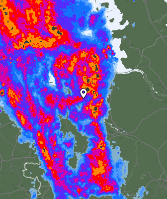 Radar