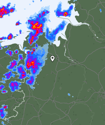 Radar