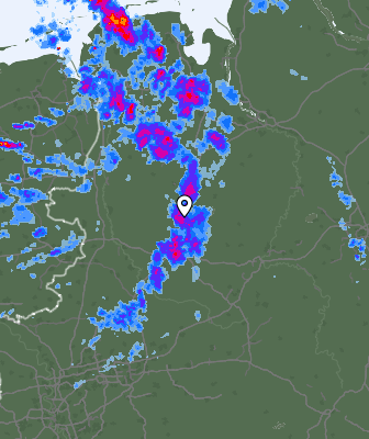 Radar