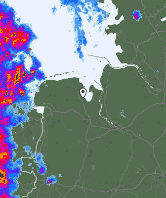 Radar