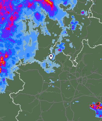 Radar