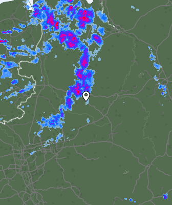 Radar