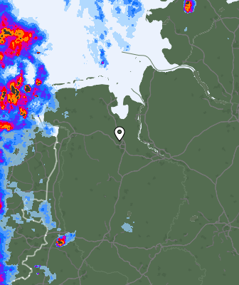 Radar
