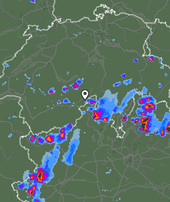 Radar