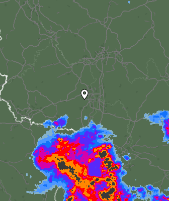 Radar