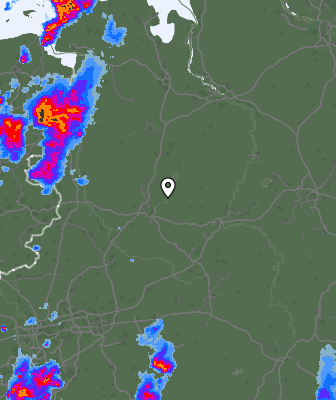Radar
