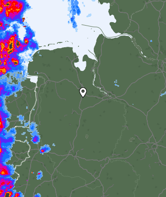 Radar