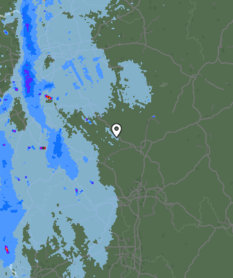 Radar