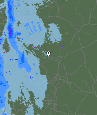 Radar